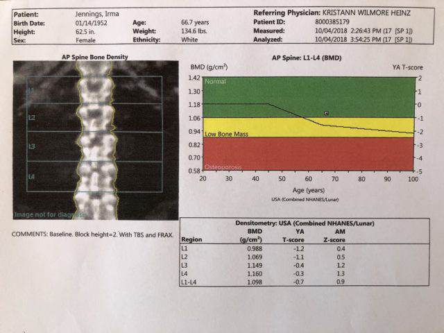 DXA Spine 2018