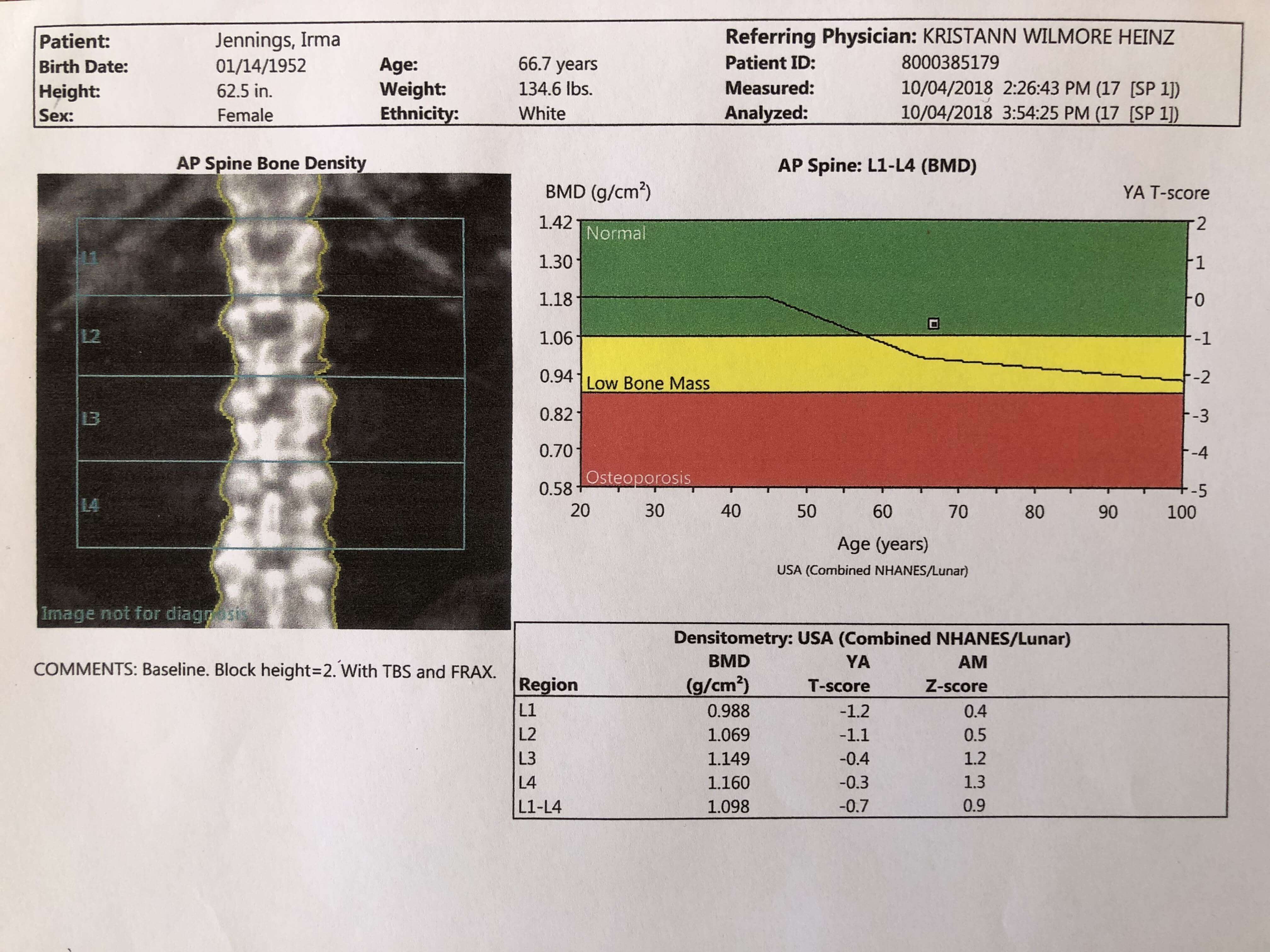 DXA spine