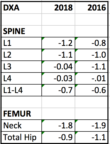 Irma's Bone Density Comparison