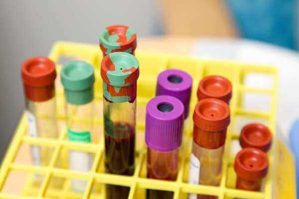 Complete Blood Count