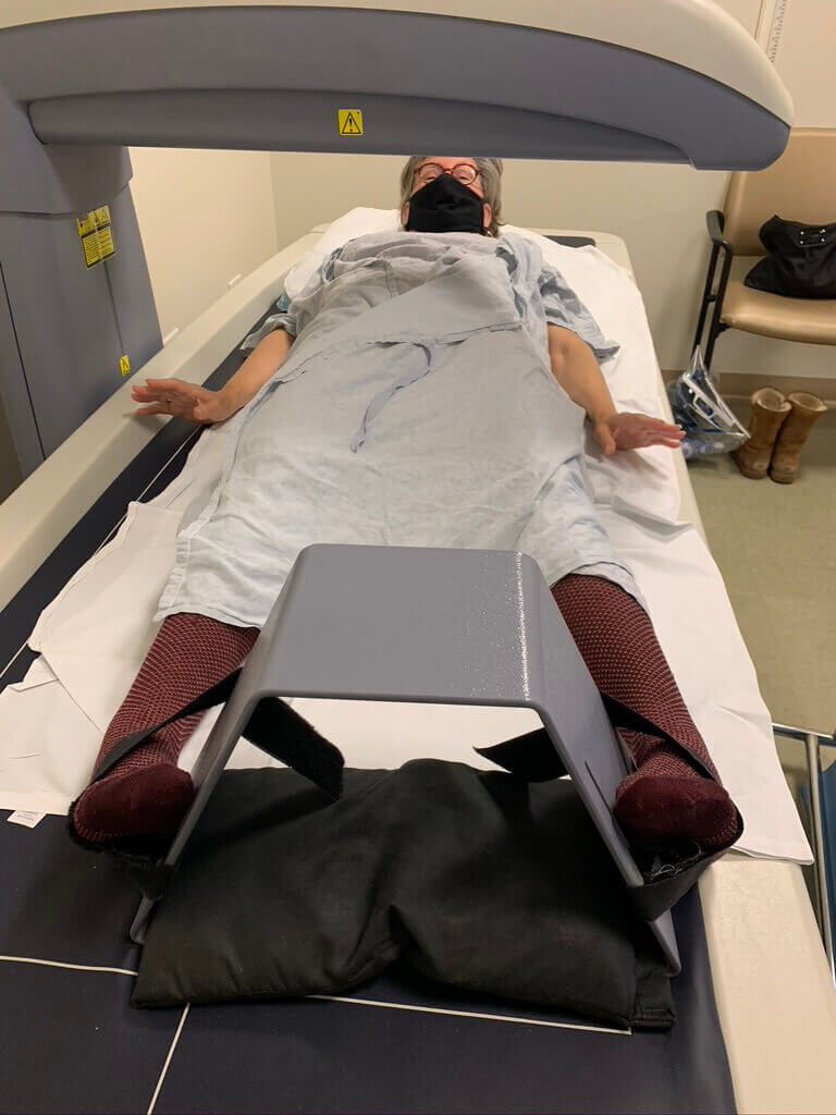 Irma feet in block for DXA test