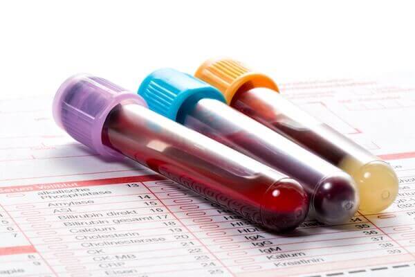 CTx + P1NP bone markers for osteoporosis